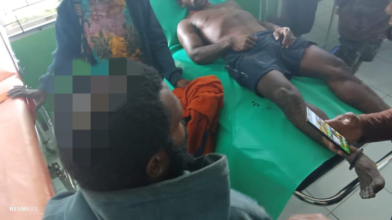 Salah satu korban yang mengalami luka-luka (SinPo.id/Dok.Polri)