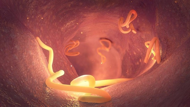 Ilustrasi. Balita di Sukabumi, Raya, meninggal dengan tubuh penuh cacing. (SinPo.id/iStockphoto/Christoph Burgstedt)