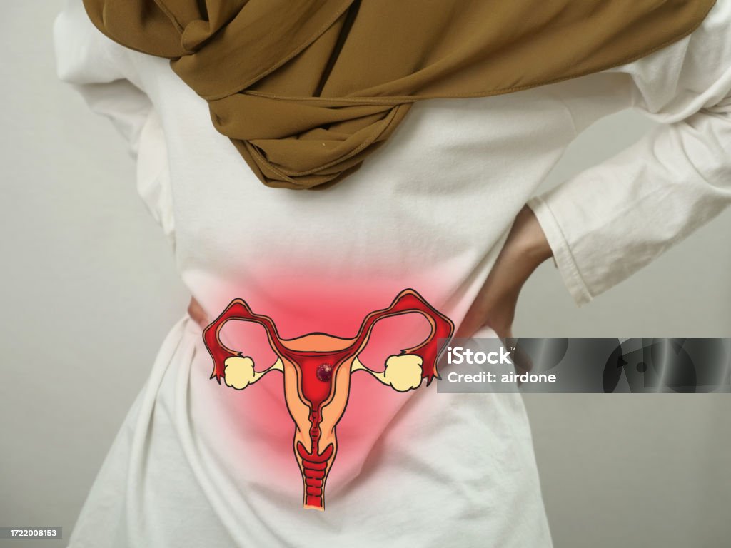 Ilustrasi gagal ginjal (pixabay.com/SinPo.id)