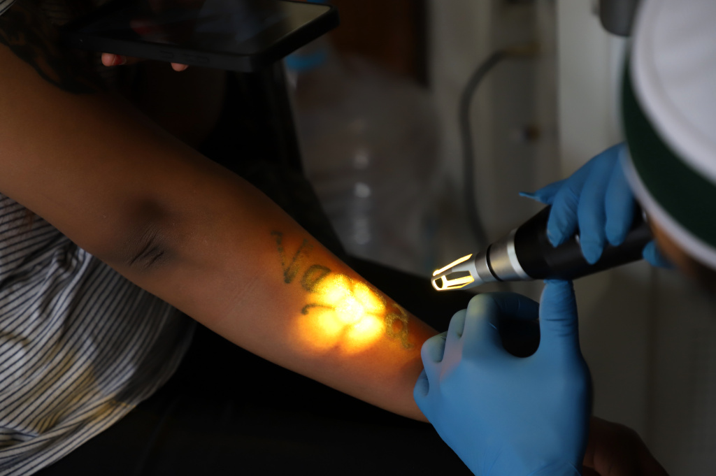 Baznas menggelar hapus tatto gratis selama bulan Suci Ramadan (Ashar/SinPo.id)