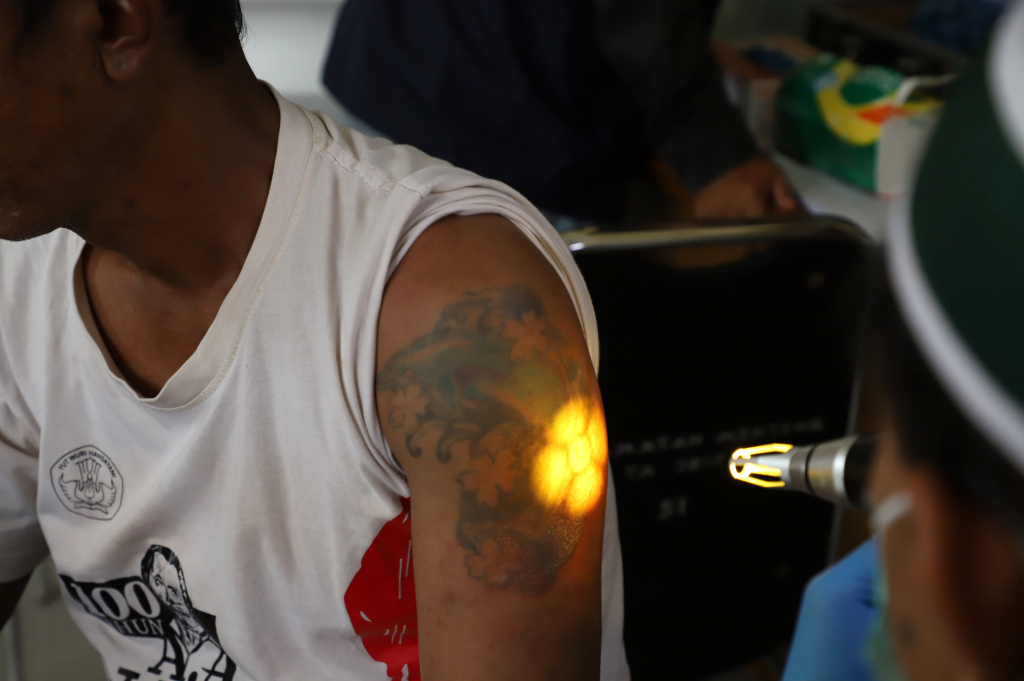Baznas menggelar hapus tatto gratis selama bulan Suci Ramadan (Ashar/SinPo.id)