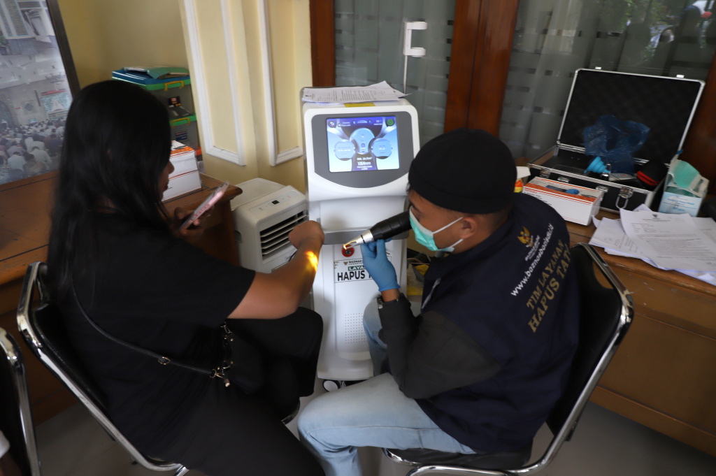 Baznas menggelar hapus tatto gratis selama bulan Suci Ramadan (Ashar/SinPo.id)